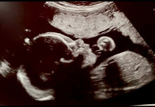 Load image into Gallery viewer, 4x6 Laser Engraved Baby Ultrasound/Sonogram on Acrylic